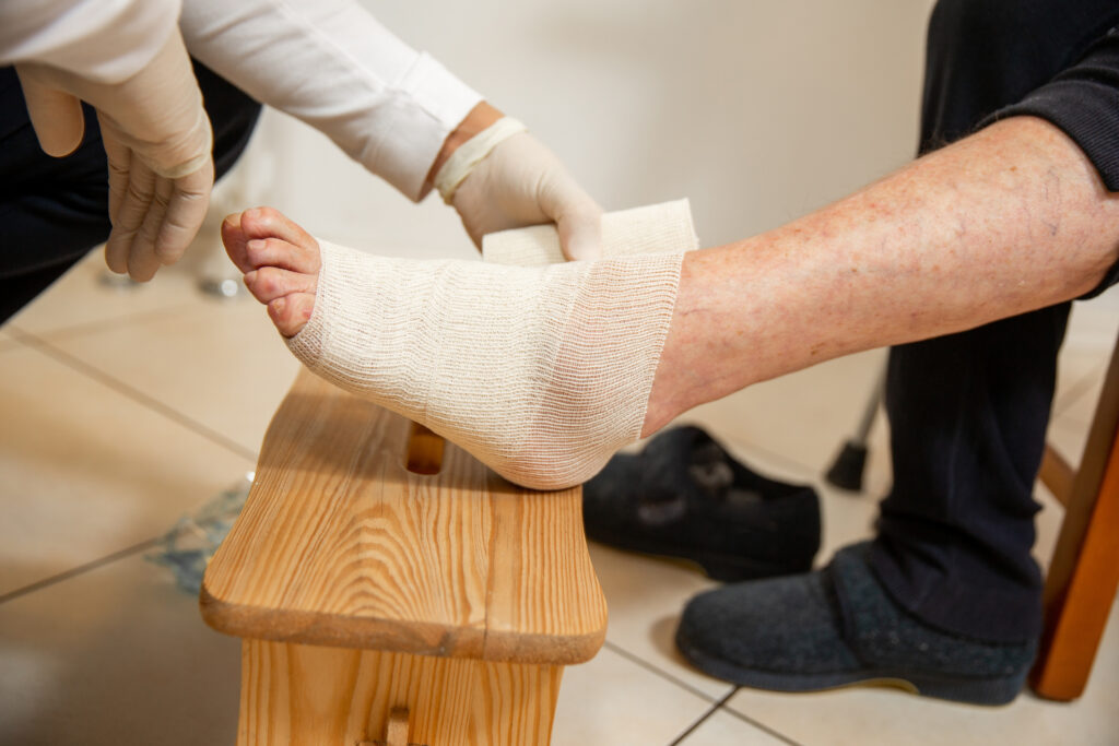 Comprehensive Orthopedic Treatment for Non-Healing Foot Wounds in Diabetes Management Strategies and Preventive Measures