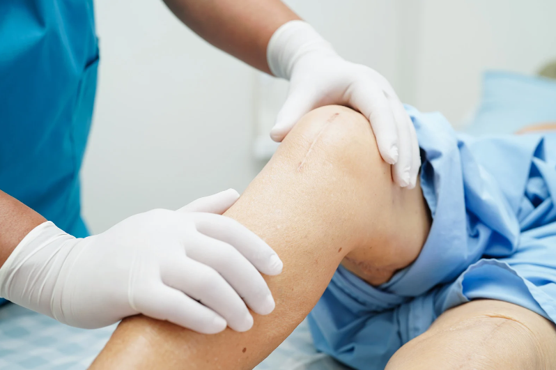 Affordable Knee Surgery A Practical Guide to Cost, Options, and Recovery