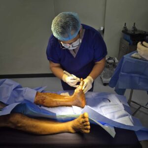 Debridement Services in Quezon City What You Need to Know for Effective Wound Care