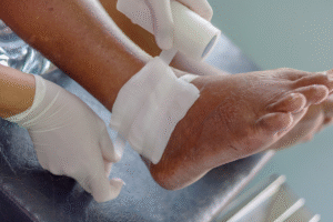 Orthopedic Treatment for Non-Healing Wounds Advanced Approaches to Effective Recovery