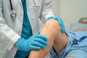 Finding the Right Knee Surgery Doctor What You Need to Know Before Your Procedure