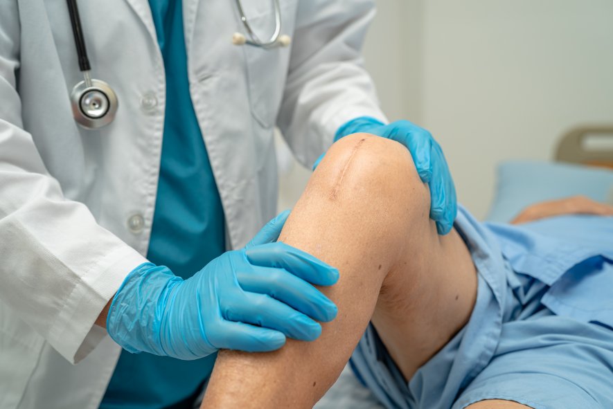 Finding the Right Knee Surgery Doctor What You Need to Know Before Your Procedure